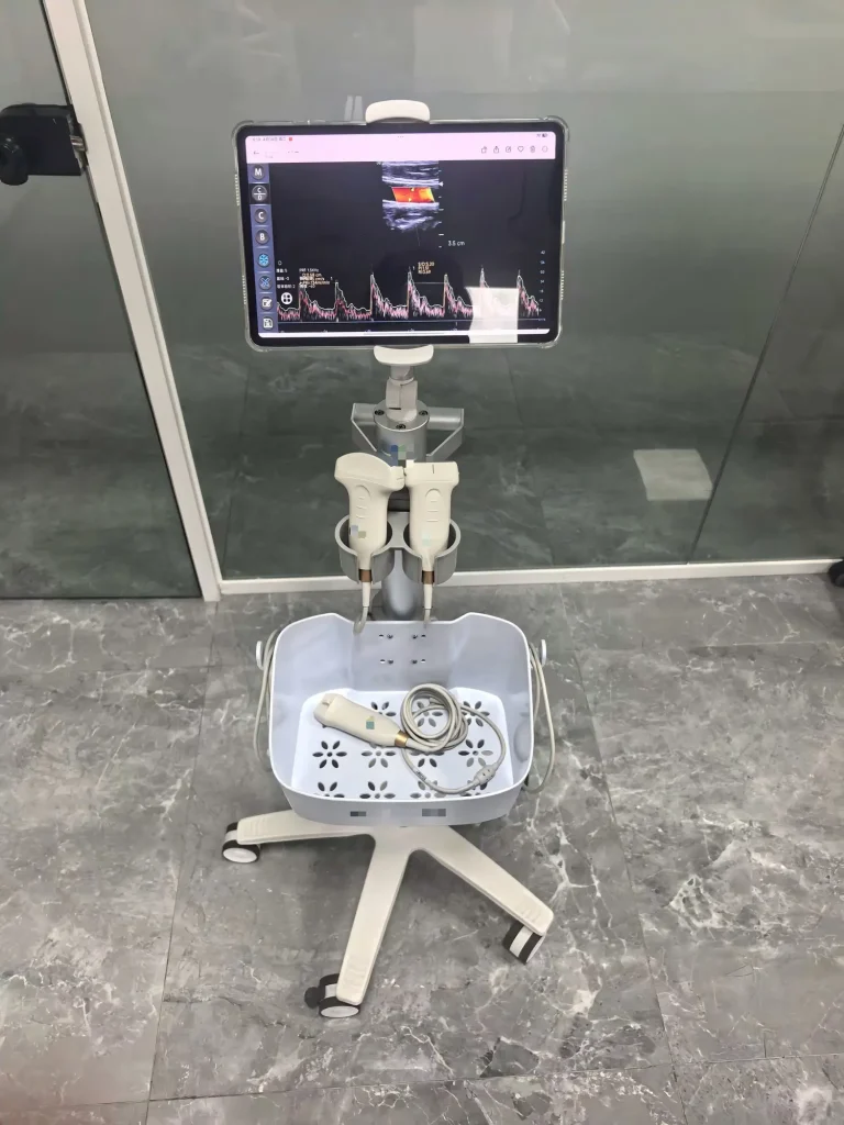 Mobile ultrasound trolley designed for ultrasound machines in hospitals and clinics by Fulightmed